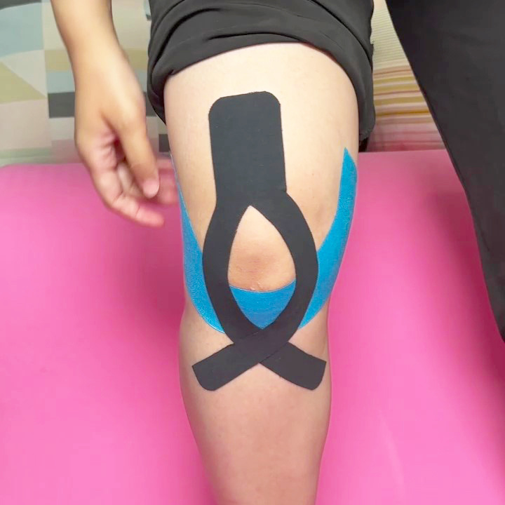 {"default":"how to use kinesiology tape to Patellar Tendonitis"}
