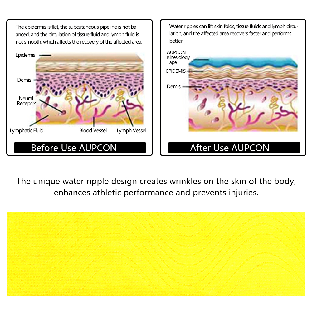 How kinesiology tape works