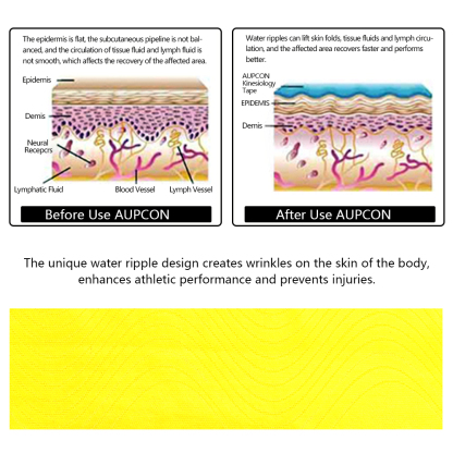 How kinesiology tape works
