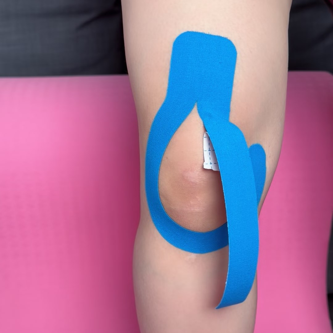 First Y-strip tail applied along the side of the knee