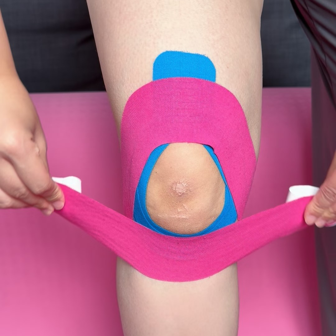 Lower I-strip applied across the patellar tendon below the kneecap