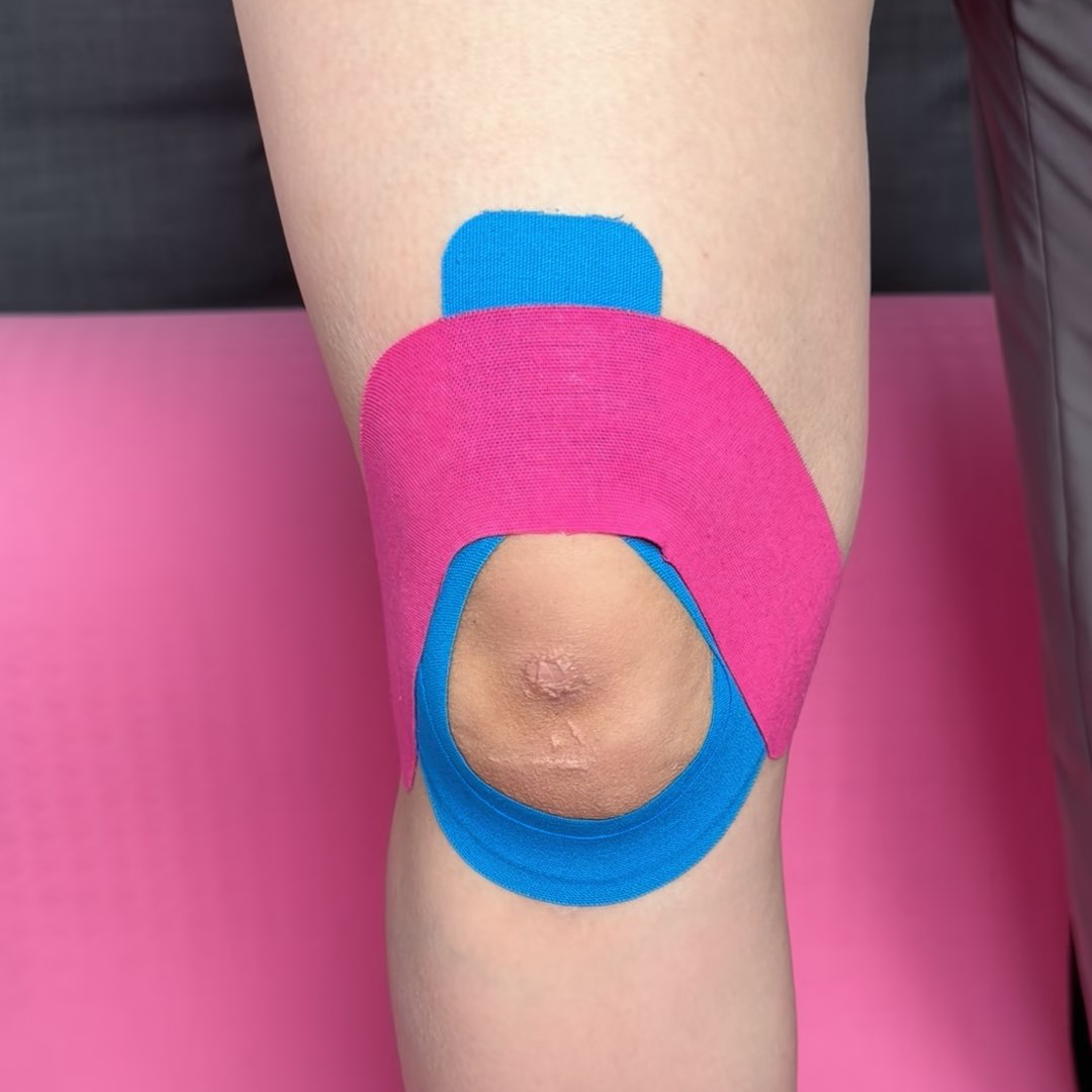 Rubbing kinesiology tape around the knee to activate the adhesive