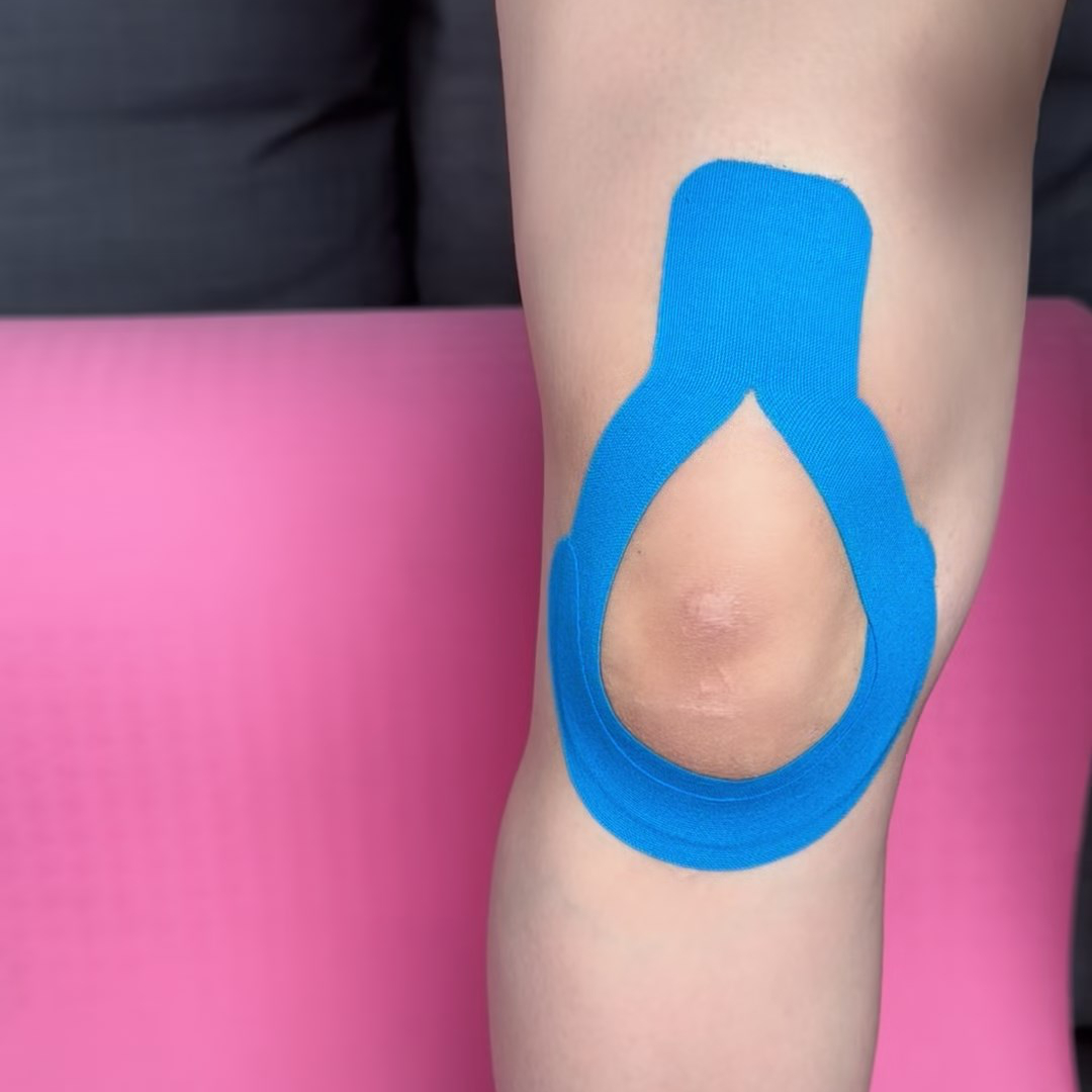 Rubbing the applied kinesiology tape to activate the adhesive