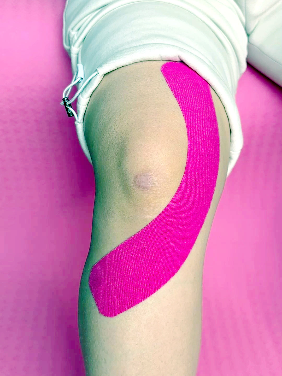 Starting below the patella, apply the first I Strips around the knee with 50% tension