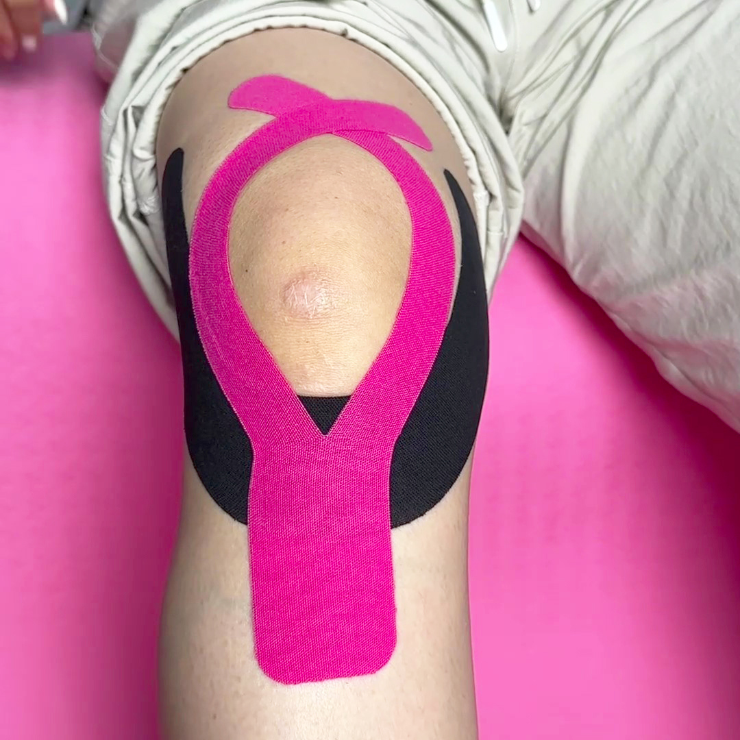 {"default":"how to apply kinesiology tape for medial meniscus pain - Rub the tape gently for 15–20 seconds. The warmth from your hands helps activate the adhesive. Avoid showering or exercising immediately afterward."}
