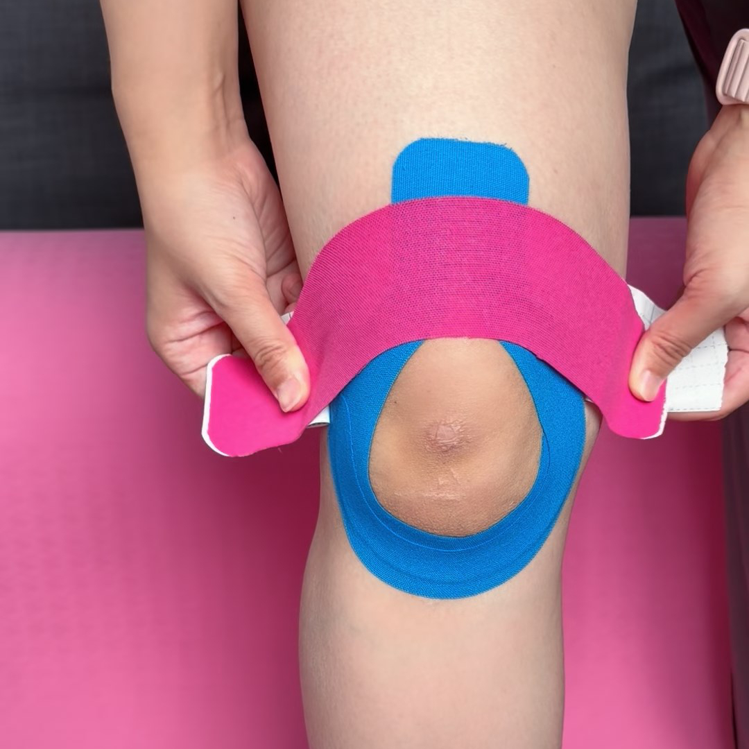 Upper I-strip applied horizontally above the kneecap