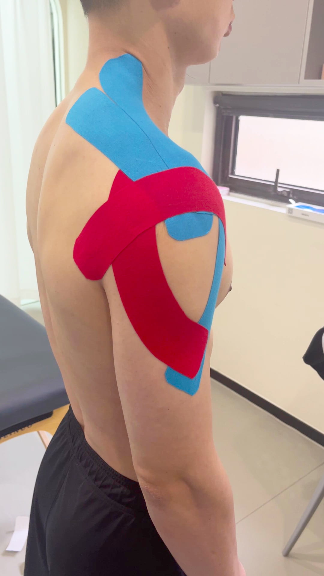 {"default":"how to apply red and blue cotton kinesiology tape for shoulder"}
