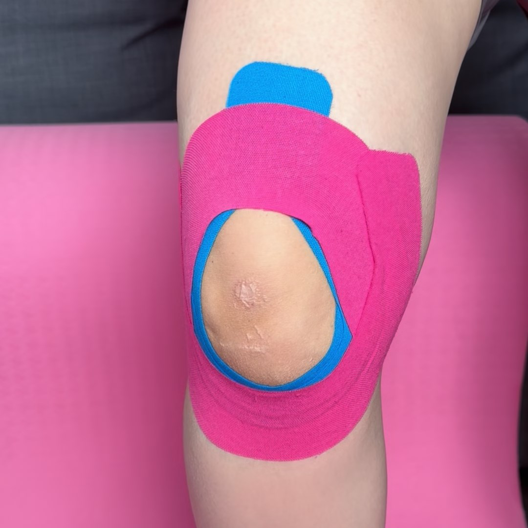 Three kinesiology tape strips arranged around the knee for patellar tendon support