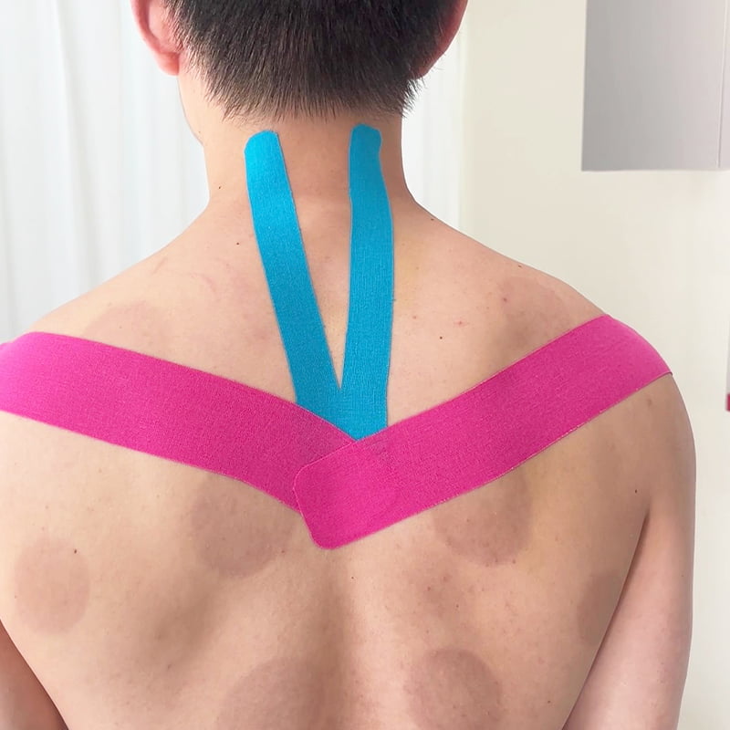 {"default":"kinesiology tape for Shoulder Blade back and neck.jpg"}
